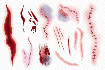 Woundcare Management